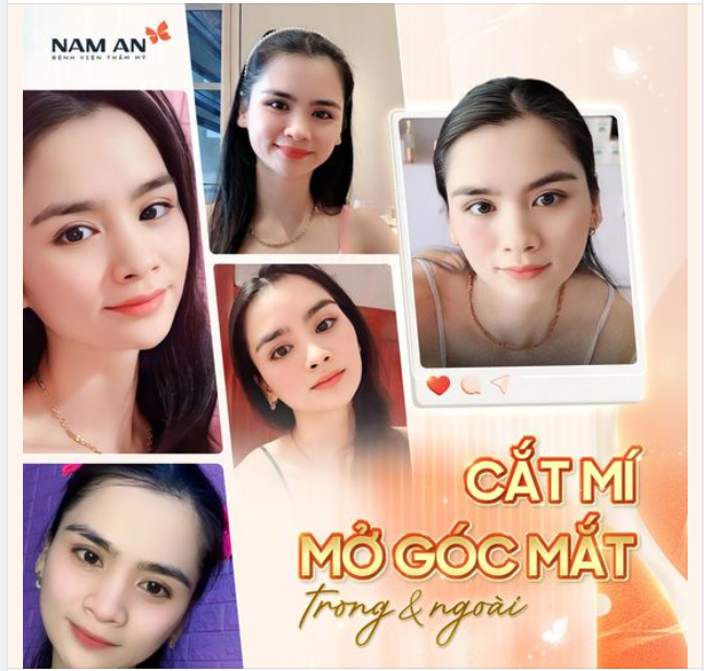 TỰ TIN TỎA SÁNG VỚI ĐÔI MẮT HOÀN HẢO.