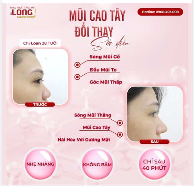 CẬP NHẬT KẾT QUẢ…LOADING 100% HOÀN THÀNH NHIỆM VỤ