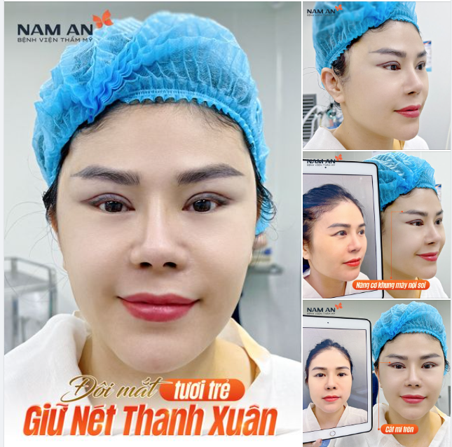 ĐÔI MẮT TƯƠI TRẺ ​​​​​​​ GIỮ NÉT THANH XUÂN