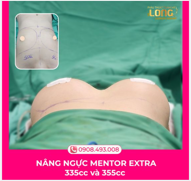 MÙA HÈ LÀ MÙA CỦA NHỮNG CÔ EM YÊU ĐỜI LỜI MỜI TỪ BIỂN XANH VẪY GỌI…