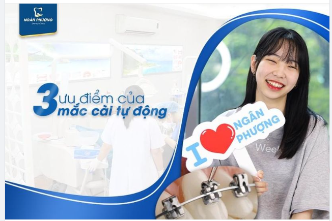 3 ưu điểm giúp MẮC CÀI TỰ ĐỘNG chiếm được trái tim đồng niềng