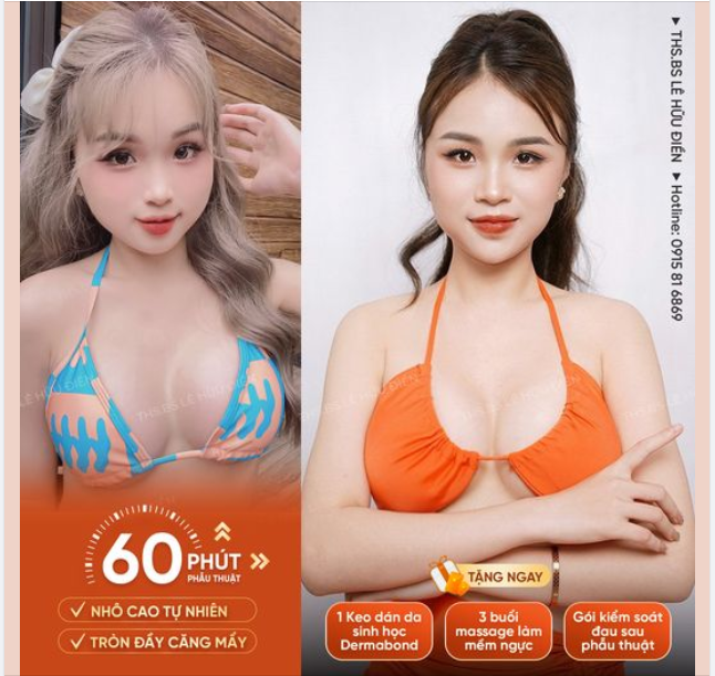 ĐỘ "LOA" XINH - NHẬP TIỆC HÈ