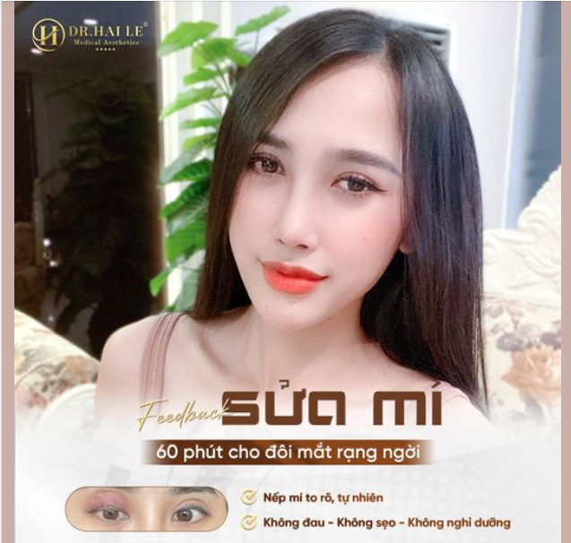 SỬA MÍ lỗi, hỏng - THAY ĐỔI DIỆN MẠO cho đôi mắt