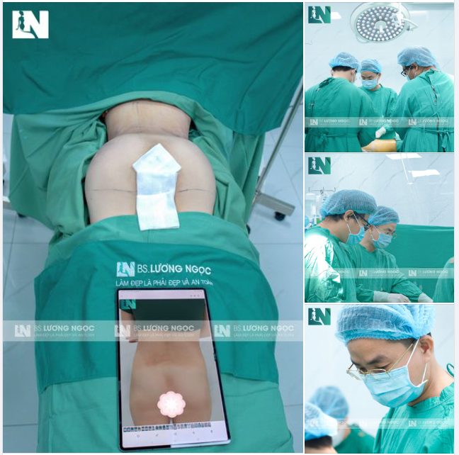 Một ngày làm việc chất lượng và hiệu quả của ekip Bác sĩ Lương Ngọc!