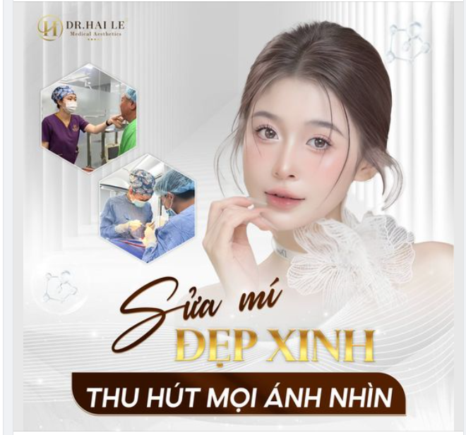 SỬA MÍ ĐẸP XINH, THU HÚT MỌI ÁNH NHÌN