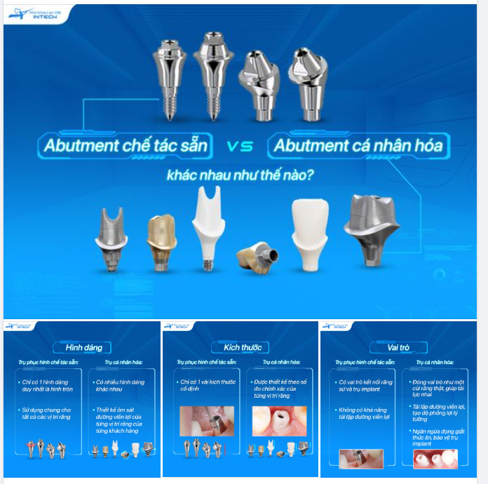 LẠC VIỆT INTECH SỬ DỤNG 100% ABUTMENT CÁ NHÂN HÓA THAY THẾ CHO ABUTMENT BÁN SẴN