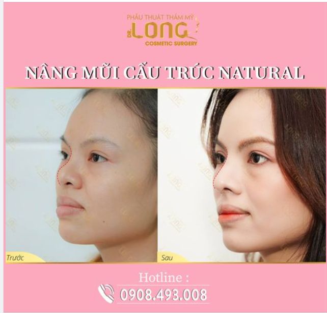 TIN ĐƯỢC KHÔNG: Mũi sau vài năm vẫn xuất sắc như ngày mới nâng?
