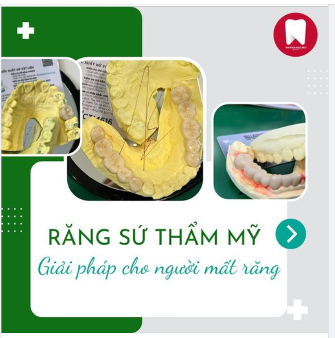 GIẢI PHÁP CHO NGƯỜI MẤT RĂNG HÀM