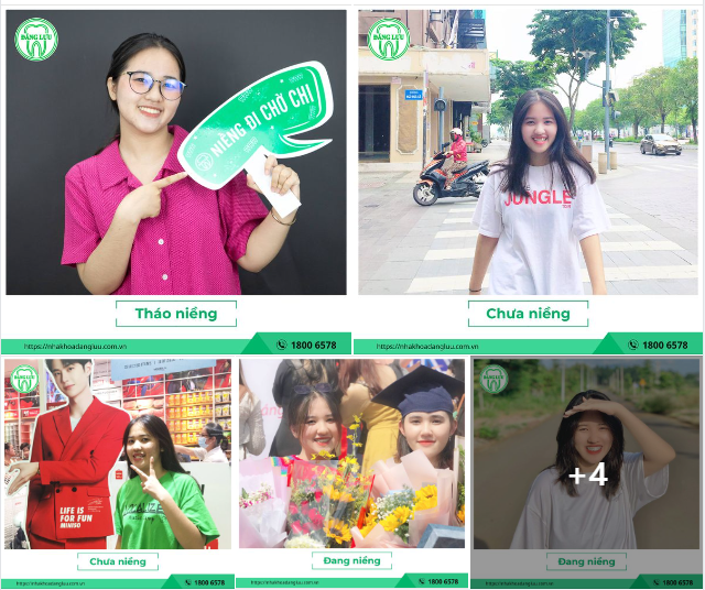 Rạng Rỡ Vẫn Luôn Ở Đó... Dưới Vô Vàn Dáng Hình