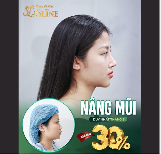 THÁNG 6 ĐẾN SLINE - NÂNG MŨI GIẢM 30%