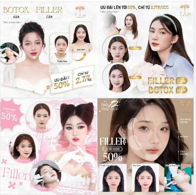 FILLER BOTOX - PHƯƠNG PHÁP LÀM ĐẸP NHANH - AN TOÀN - TỰ NHIÊN
