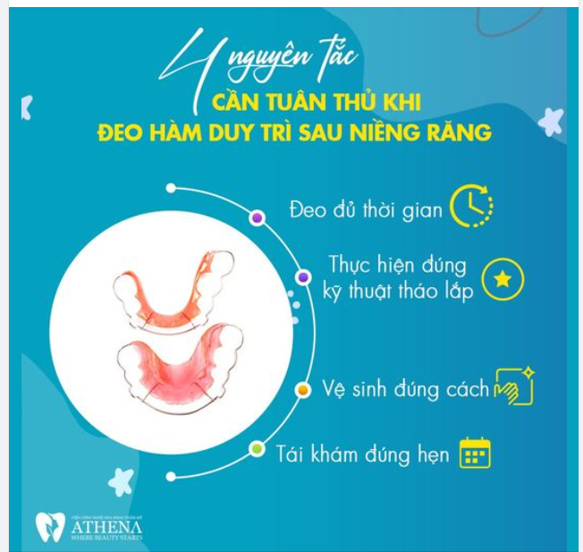 4 NGUYÊN TẮC CẦN TUÂN THỦ KHI ĐEO HÀM DUY TRÌ SAU NIỀNG RĂNG