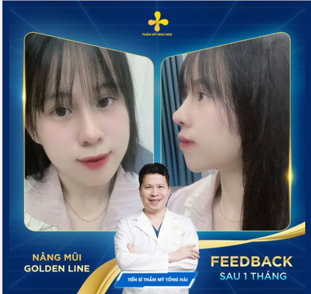 Tuổi trẻ nhất định phải làm những gì mình thích.