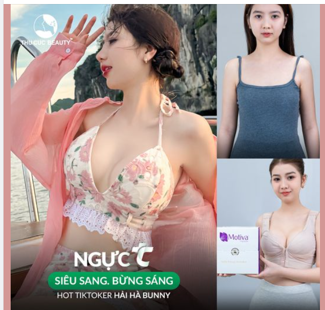Vòng 1 upsize - X2 vẻ đẹp  Ngực TC giảm ngay 30% tại TM Thu Cúc