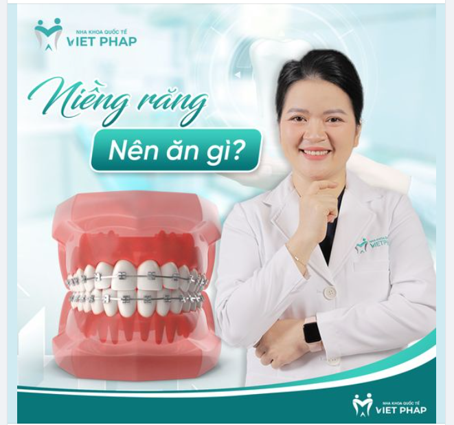 NIỀNG RĂNG NÊN ĂN GÌ?
