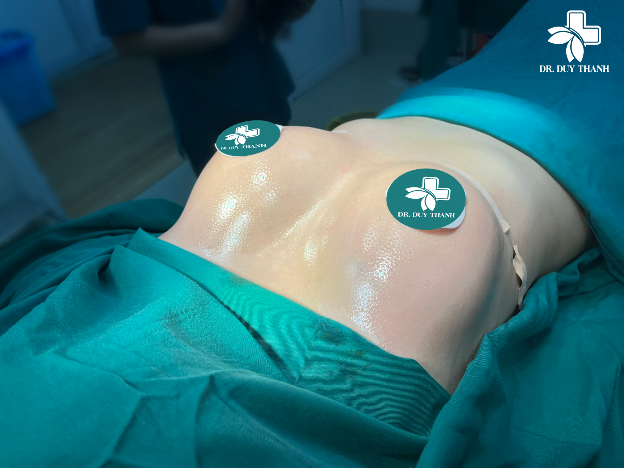 Combo Ngực đẹp, Eo thon, Dáng đẹp chỉ có tại Dr Duy Thanh