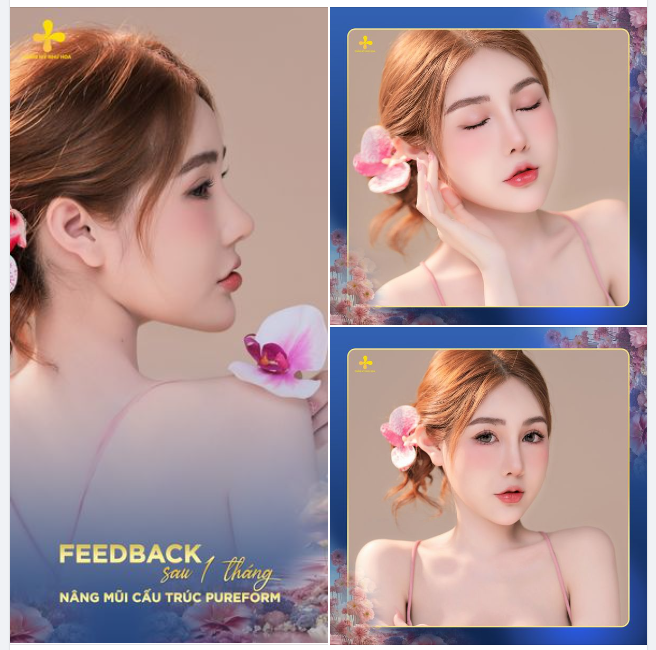 Dáng mũi 1 tháng tuổi của bạn Đặng Phương đến từ Hải Dương.