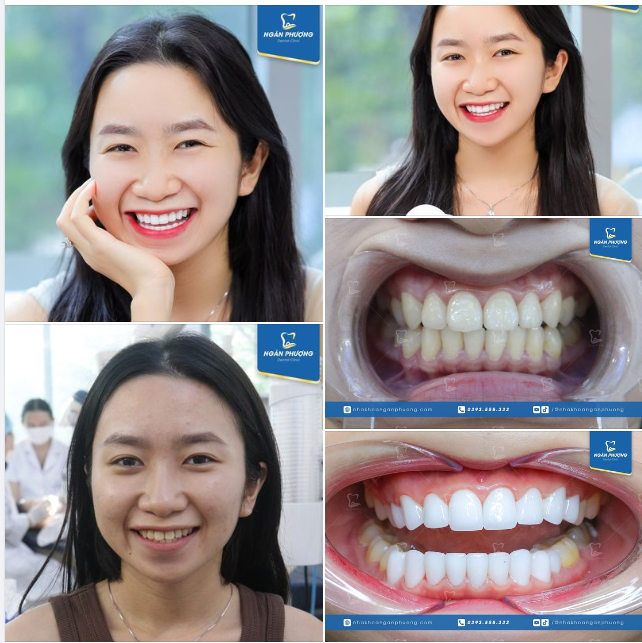 Chim khôn kêu tiếng rảnh rang. Người đẹp làm sứ sáng bừng ngày bão giông