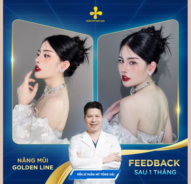 Feedback của Ngọc Linh - Nàng makeup artist đến từ Vĩnh Phúc: Visual thăng hạng sau khi sửa mũi.
