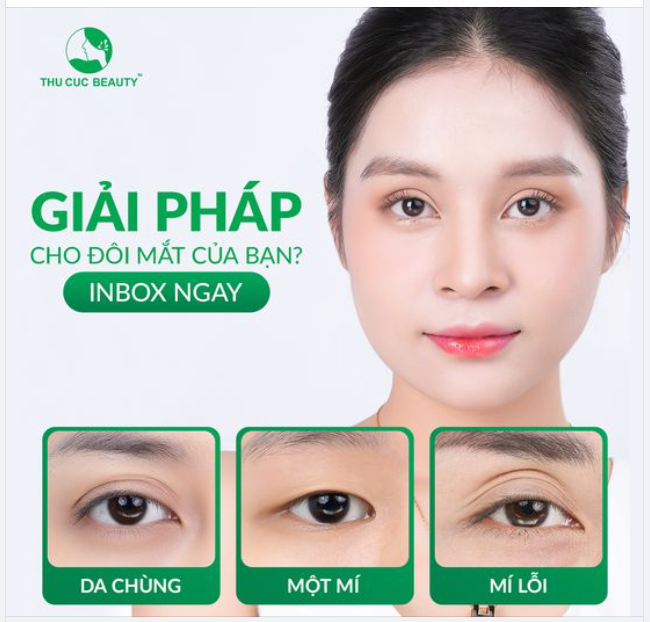 Mí đẹp - Mắt xinh tự tin với nhan sắc vạn người mê