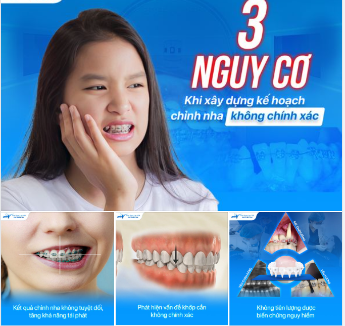 "SAI MỘT LY, ĐI MỘT DẶM" - SẼ THẾ NÀO NẾU ÁP DỤNG KẾ HOẠCH CHỈNH NHA KHÔNG CHÍNH XÁC?