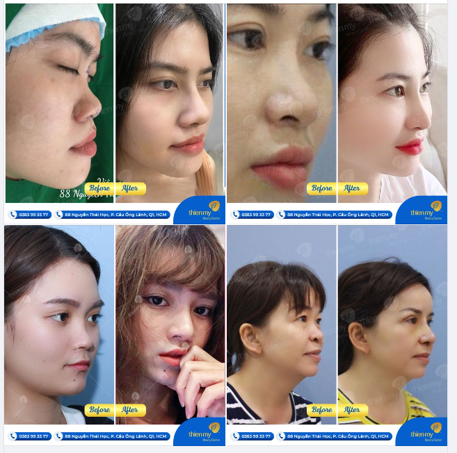Hình ảnh những khách hàng xinh đẹp dưới đây là minh chứng cho sự tự nhiên và tinh tế mà Thiện Mỹ mang lại.