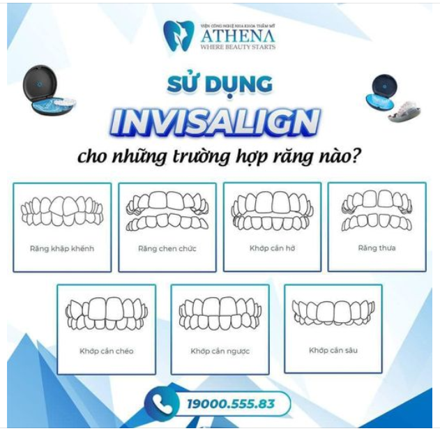 Sử dụng INVISALIGN cho những trường hợp răng nào?