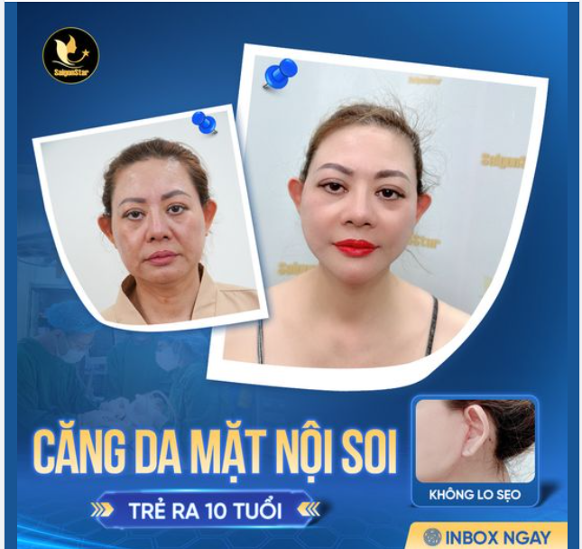 CĂNG DA MẶT NỘI SOI - BÍ KIẾP "CẢI LÃO HOÀN ĐỒNG"