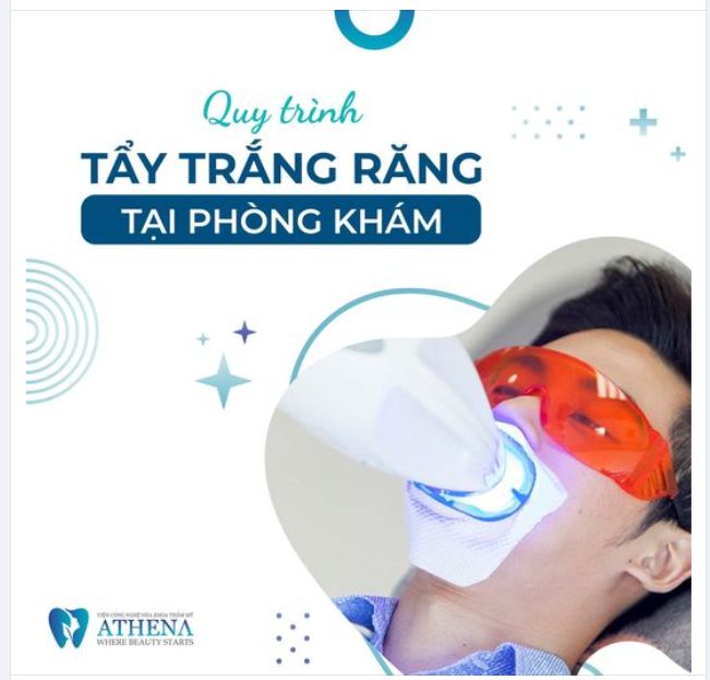 Nụ Cười Sáng Rạng Với Tẩy Trắng Răng Đèn Plasma Tại Nha Khoa Athena
