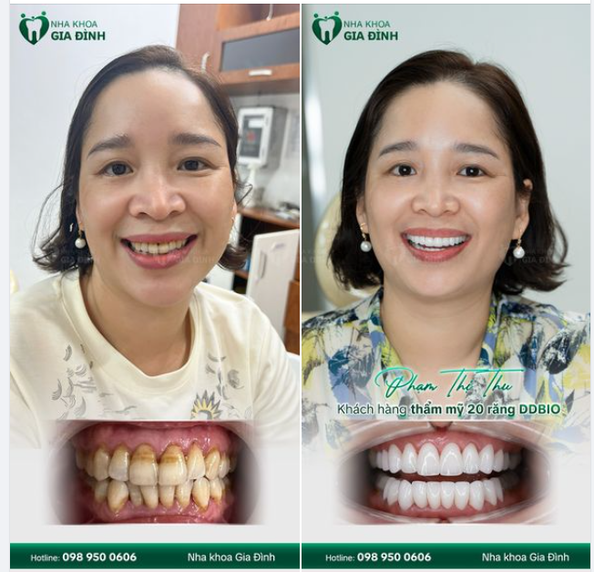 TÂN TRANG NỤ CƯỜI - TÌM LẠI CẢ THANH XUÂN