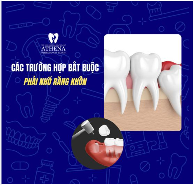 Bắt buộc nhổ răng khi gặp những trường hợp này