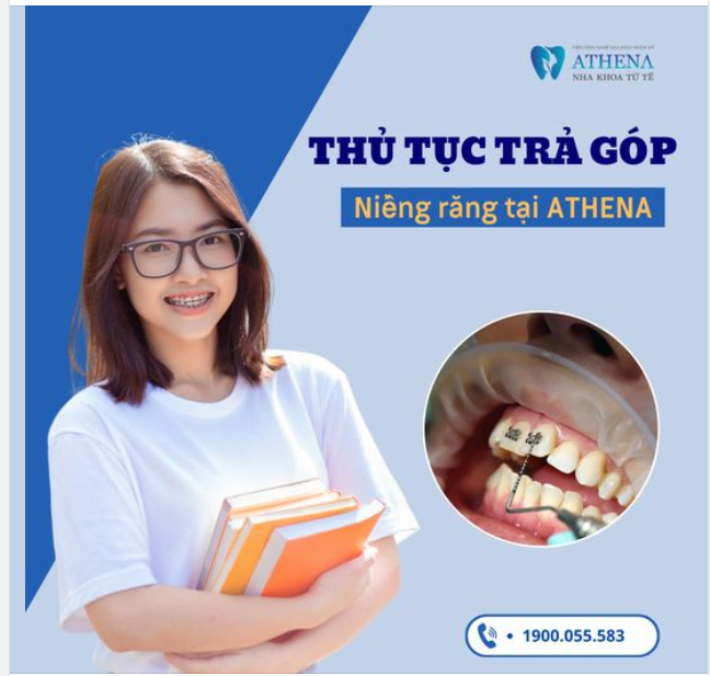 Tiếp tục niềng răng trả góp cho học sinh, sinh viên tại ATHENA