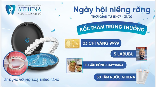 Niềng răng biết trước kết quả, kế hoạch điều trị chính xác tuyệt đối