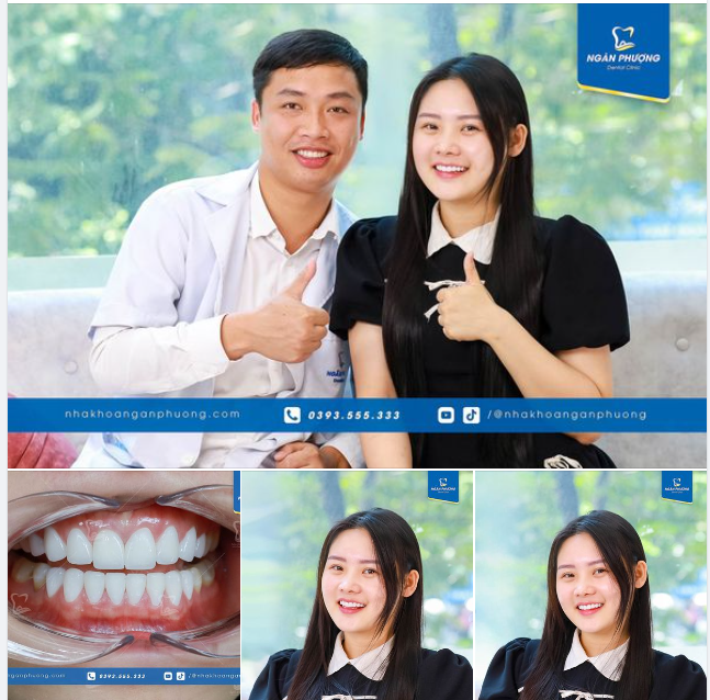 Tiktoker Thanh Tuyền tái khám sau 3 năm làm răng sứ