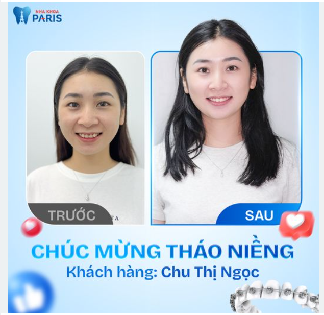 DÀN ĐỀU KHẤP KHỂNH CHỈ VỚI LIỆU TRÌNH 18 THÁNG