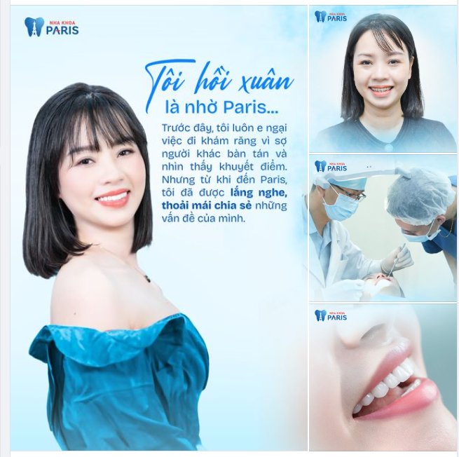 Chia sẻ của chị Vân Anh sau khi làm răng sứ tại Nha khoa Paris.