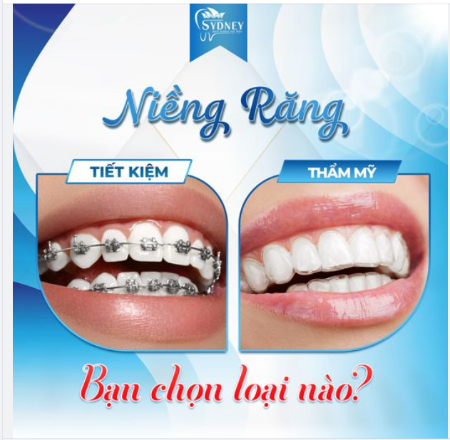 NIỀNG RĂNG THẨM MỸ HAY TIẾT KIỆM. BẠN CHỌN LOẠI NÀO?