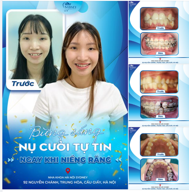 BỪNG SÁNG NỤ CƯỜI TỰ TIN NGAY KHI VỪA NIỀNG