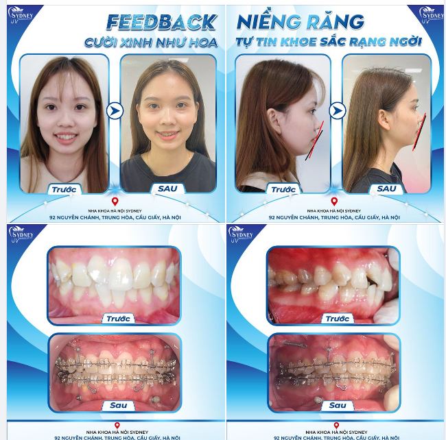CƯỜI XINH NHƯ HOA - TỰ TIN KHOE SẮC RẠNG NGỜI