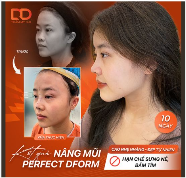 Dáng mũi nhẹ nhàng cho những cô nàng thích tự nhiên.