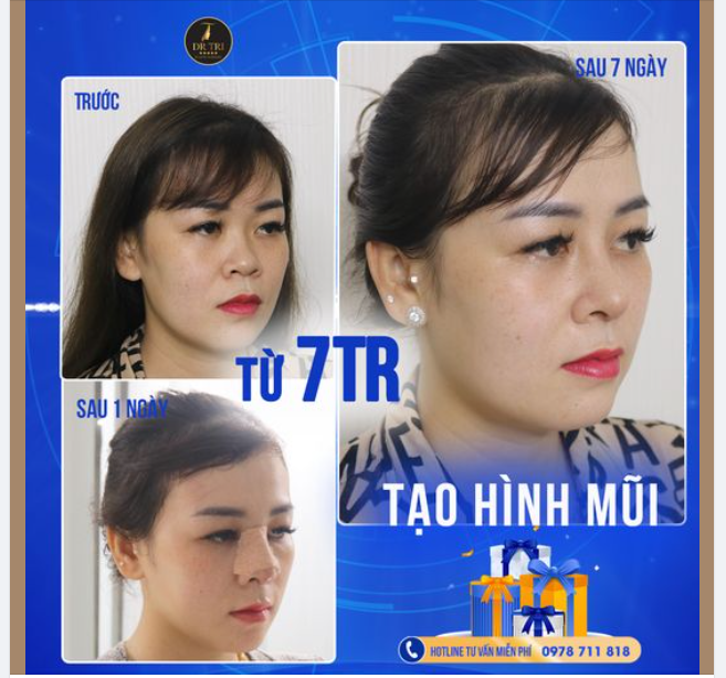 "Choáy" cùng Đại Tiệc - Ưu Đãi Sinh Nhật Dr Trí