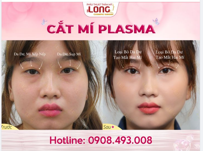 CHỌN ĐÚNG BÁC SĨ - MẮT ĐẸP DÀI LÂU