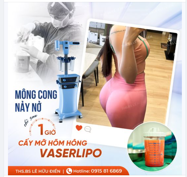 V3 NẢY NỞ CHỈ SAU 1 GIỜ CẤY MỠ VASERLIPO