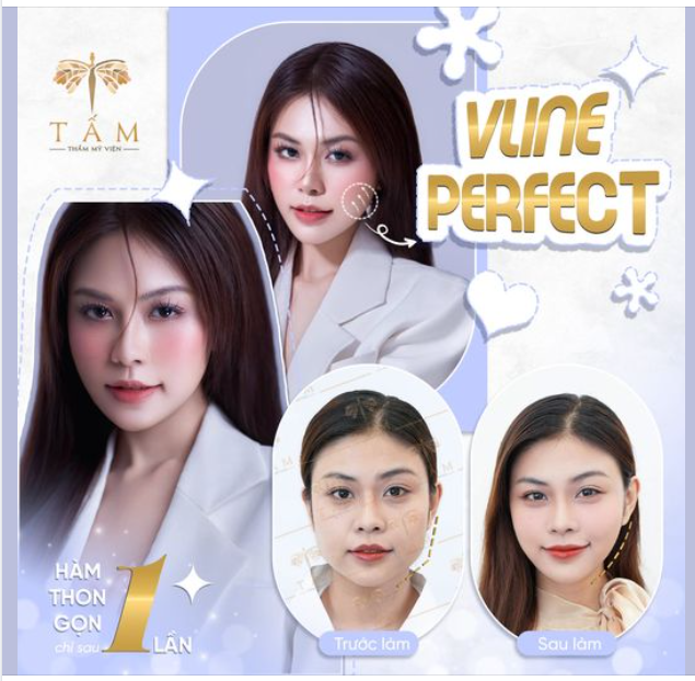 VLINE PERFECT - DẪN ĐẦU XU THẾ THON GỌN HÀM KHÔNG XÂM LẤN