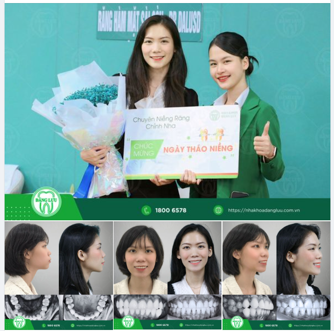 THÁO NIỀNG, BẬT CHẾ ĐỘ CƯỜI XINH