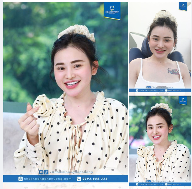 "Chị làm thẩm mỹ nên mình muốn đẹp, cũng không suy nghĩ nhiều, xem anh Tuấn nhiều rồi quyết định rất nhanh."