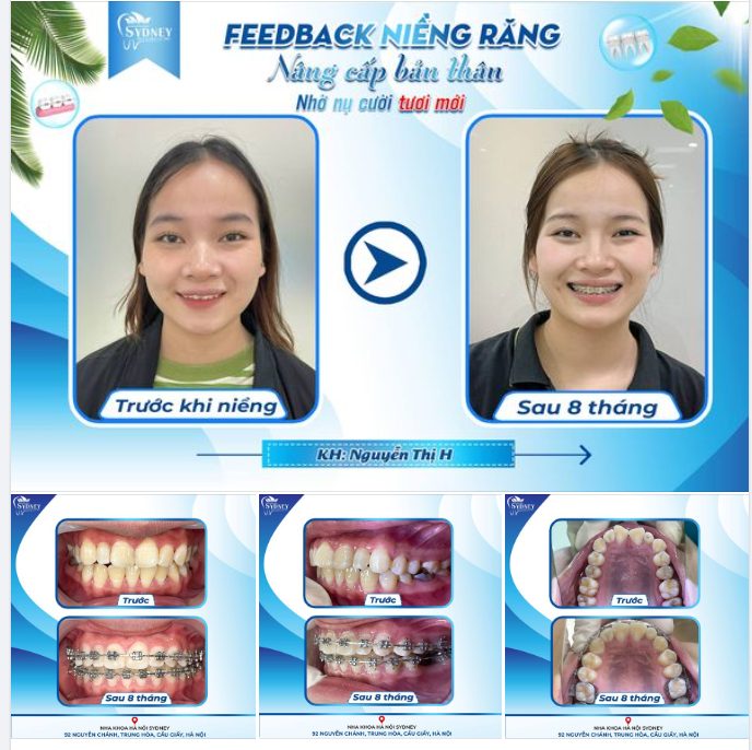NÂNG CẤP BẢN THÂN NHỜ NỤ CƯỜI TƯƠI MỚI