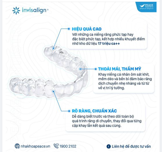 NIỀNG RĂNG DỰ ĐOÁN TRƯỚC KẾT QUẢ, CHÍNH XÁC CAO MÀ KHÔNG HỀ PHỨC TẠP