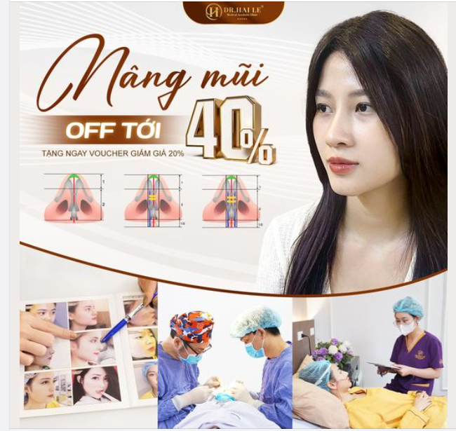Nâng mũi cao bay, voucher về tay!