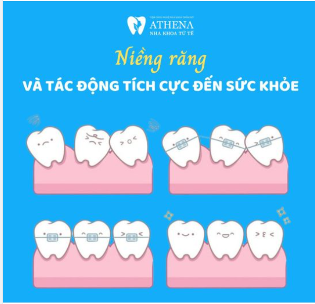 Niềng răng và tác động tích cực đến sức khỏe tổng thể 